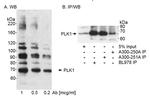 PLK1 Antibody in Western Blot (WB)