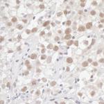 Fen1 Antibody in Immunohistochemistry (Paraffin) (IHC (P))