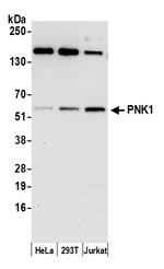 PNK1 Antibody in Western Blot (WB)