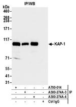 KAP-1 Antibody in Immunoprecipitation (IP)