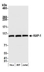 KAP-1 Antibody in Western Blot (WB)