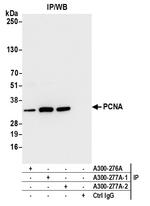 PCNA Antibody in Immunoprecipitation (IP)