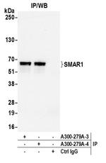 SMAR1/BANP Antibody in Immunoprecipitation (IP)