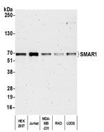 SMAR1/BANP Antibody in Western Blot (WB)