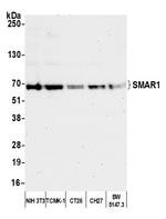 SMAR1/BANP Antibody in Western Blot (WB)