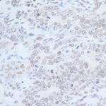 Rad6 Antibody in Immunohistochemistry (Paraffin) (IHC (P))