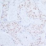 Rad6 Antibody in Immunohistochemistry (Paraffin) (IHC (P))