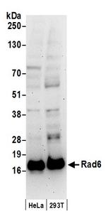 Rad6 Antibody in Western Blot (WB)