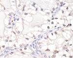 HIF1-alpha Antibody in Immunohistochemistry (Paraffin) (IHC (P))