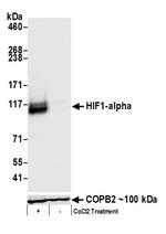 HIF1-alpha Antibody in Western Blot (WB)