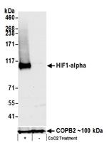 HIF1-alpha Antibody in Western Blot (WB)