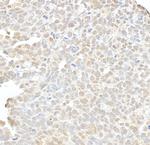 hSET1 Antibody in Immunohistochemistry (Paraffin) (IHC (P))