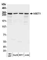 hSET1 Antibody in Western Blot (WB)