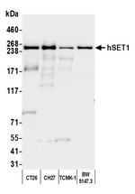 hSET1 Antibody in Western Blot (WB)