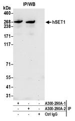 hSET1 Antibody in Immunoprecipitation (IP)