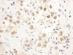 Chk1 Antibody in Immunohistochemistry (Paraffin) (IHC (P))