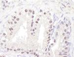 ATM Antibody in Immunohistochemistry (Paraffin) (IHC (P))