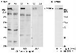 ATM Antibody in Western Blot (WB)