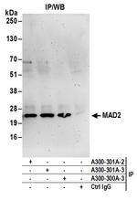 MAD2 Antibody in Immunoprecipitation (IP)