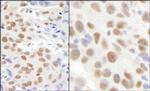 KIAA0082 Antibody in Immunohistochemistry (Paraffin) (IHC (P))