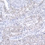 RAP1 Antibody in Immunohistochemistry (Paraffin) (IHC (P))