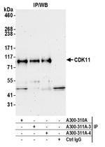 CDK11 Antibody in Immunoprecipitation (IP)