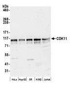 CDK11 Antibody in Western Blot (WB)