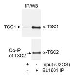 TSC1 Antibody in Immunoprecipitation (IP)