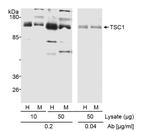 TSC1 Antibody in Western Blot (WB)