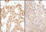 Ubiquitin Antibody in Immunohistochemistry (Paraffin) (IHC (P))