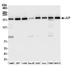 JLP Antibody in Western Blot (WB)