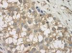 JLP Antibody in Immunohistochemistry (Paraffin) (IHC (P))