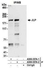 JLP Antibody in Immunoprecipitation (IP)