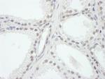 SRC1 Antibody in Immunohistochemistry (Paraffin) (IHC (P))