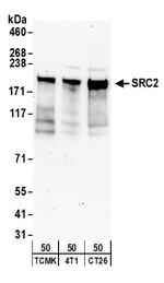 NCOA2/SRC2 Antibody in Western Blot (WB)