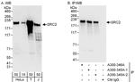 NCOA2/SRC2 Antibody in Western Blot (WB)