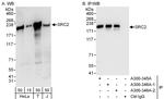 NCOA2/SRC2 Antibody in Western Blot (WB)