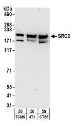 NCOA2/SRC2 Antibody in Western Blot (WB)