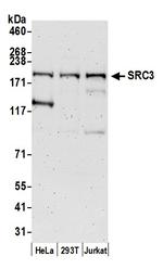 SRC3 Antibody in Western Blot (WB)