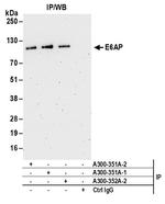 E6AP Antibody in Immunoprecipitation (IP)