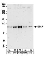 E6AP Antibody in Western Blot (WB)