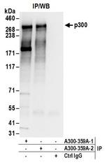 p300 Antibody in Immunoprecipitation (IP)