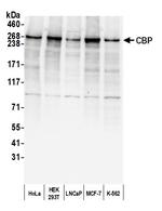 CBP Antibody in Western Blot (WB)