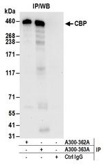 CBP Antibody in Immunoprecipitation (IP)