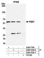 PBEF Antibody in Immunoprecipitation (IP)