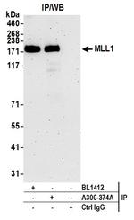 MLL1 Antibody in Immunoprecipitation (IP)