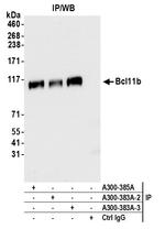 Bcl11b Antibody in Immunoprecipitation (IP)