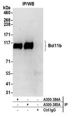 Bcl11b Antibody in Immunoprecipitation (IP)