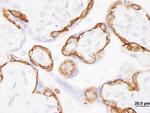 EGFR Antibody in Immunohistochemistry (Paraffin) (IHC (P))