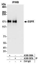 EGFR Antibody in Immunoprecipitation (IP)